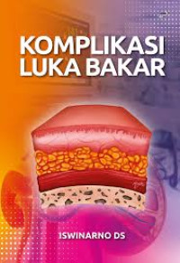 ebook kmb : Komplikasi Luka Bakar