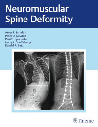 Image of Ebook : Neuromuscular Spine Deformity