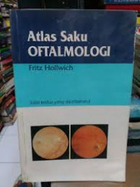 Image of KMB: Atlas Saku Oftamologi