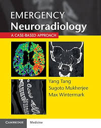 Image of Ebook Neurologi : Emergency Neuroradiology ; A Case Based Approach