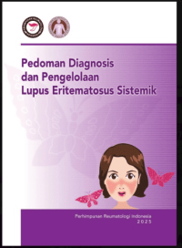 Image of Ebook : Pedoman Diagnosis dan Pengelolaan Lupus Eritematosus Sistemik
